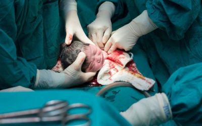 ضرورة ومخاطر الولادة القيصرية وطرق التحضير لها