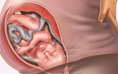 زيادة وزن الجنين في بطن الأم.. الأسباب والمخاطر