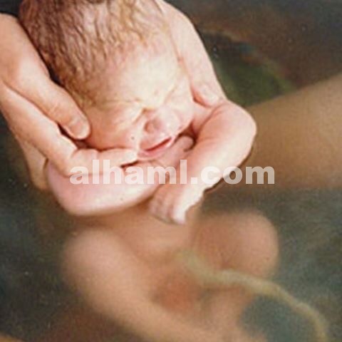 طريقة الولادة تحت الماء