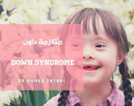 سبب متلازمة داون ، Down syndrome