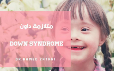 سبب متلازمة داون ، Down syndrome